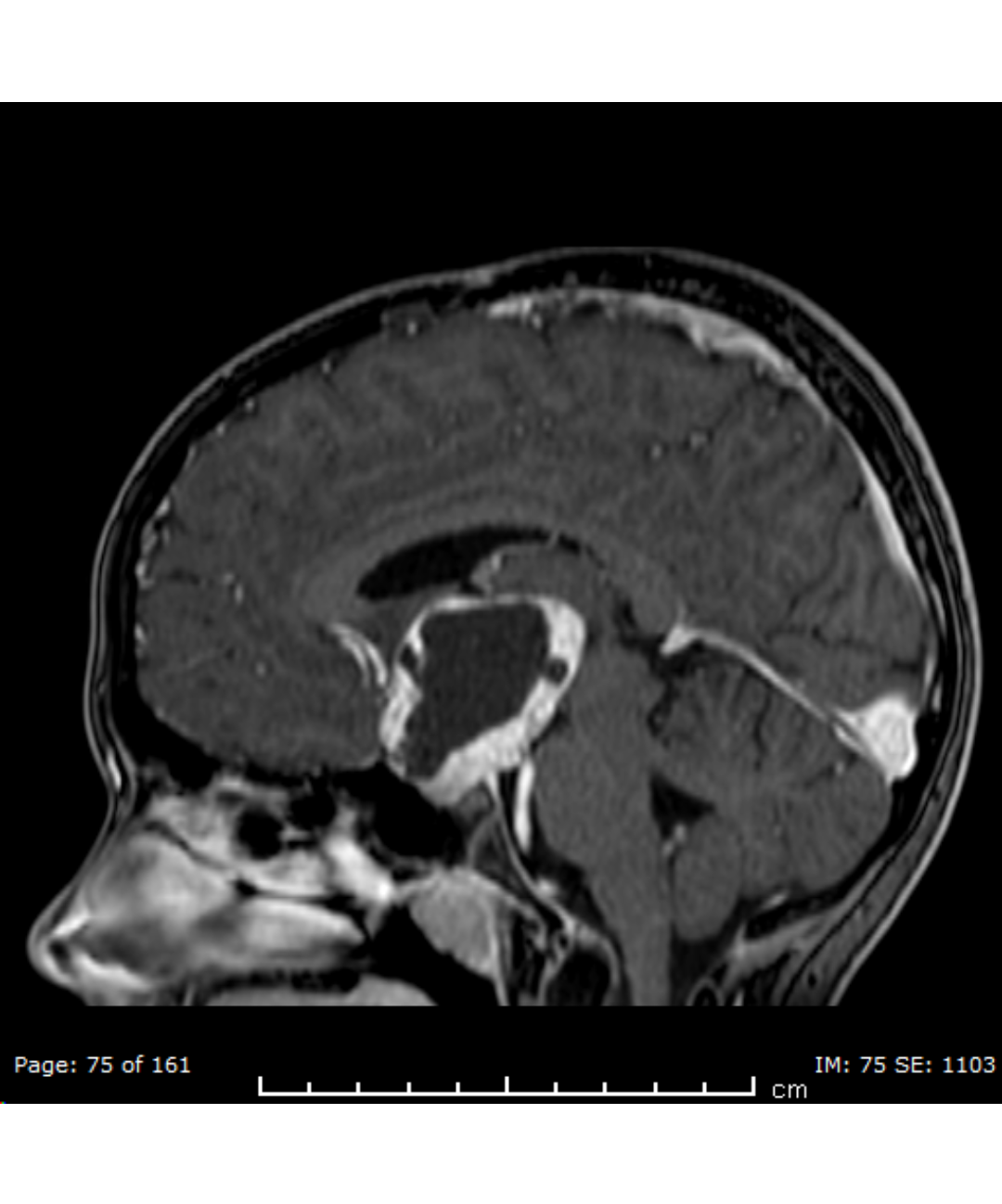 ACP Meeting - ACP Scan 2
